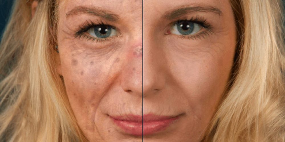 влияние солнца на кожу лица